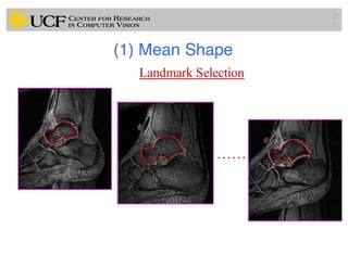 (1) Mean Shape
27
……
Landmark Selection
 