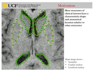 3
Motivation
Most structures of
clinical interest have a
characteristic shape
and anatomical
location relative to
other structures
Brain image shows:
• Ventricles
• Caudate nucleus
• Lentiform nucleus
 