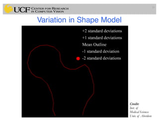 Variation in Shape Model
33
Credit:
Inst. of
Medical Sciences
Univ. of Aberdeen
 