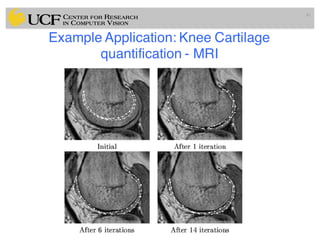 Example Application: Knee Cartilage
quantification - MRI
41
 