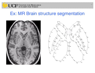 Ex: MR Brain structure segmentation
42
 