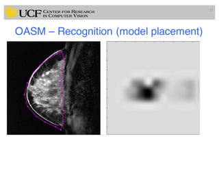 OASM – Recognition (model placement)
55
 