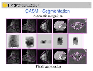 OASM - Segmentation
56
Automatic recognition
Final segmentation
 