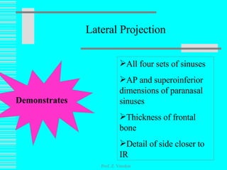 Lateral Projection Prof. Z. Vinokur Demonstrates All four sets of sinuses AP and superoinferior dimensions of paranasal sinuses Thickness of frontal bone Detail of side closer to IR 