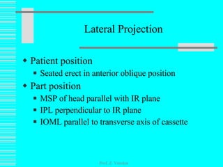 Lateral Projection Patient position Seated erect in anterior oblique position Part position MSP of head parallel with IR plane IPL perpendicular to IR plane IOML parallel to transverse axis of cassette Prof. Z. Vinokur 
