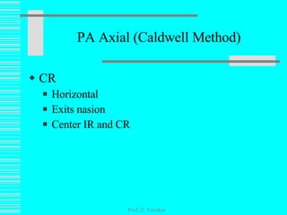 PA Axial (Caldwell Method) CR Horizontal Exits nasion Center IR and CR Prof. Z. Vinokur 