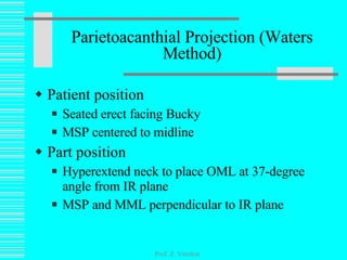 Patient position Seated erect facing Bucky  MSP centered to midline Part position Hyperextend neck to place OML at 37-degree angle from IR plane MSP and MML perpendicular to IR plane Parietoacanthial Projection (Waters Method) Prof. Z. Vinokur 