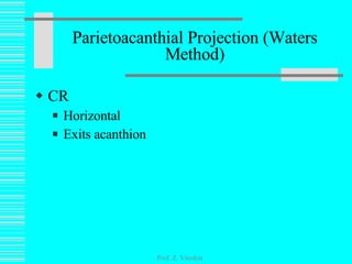 CR Horizontal Exits acanthion Parietoacanthial Projection (Waters Method) Prof. Z. Vinokur 