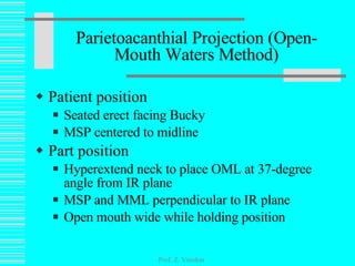 Patient position Seated erect facing Bucky MSP centered to midline Part position Hyperextend neck to place OML at 37-degree angle from IR plane MSP and MML perpendicular to IR plane Open mouth wide while holding position Parietoacanthial Projection (Open-Mouth Waters Method) Prof. Z. Vinokur 