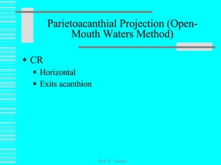 CR Horizontal Exits acanthion Parietoacanthial Projection (Open-Mouth Waters Method) Prof. Z. Vinokur 