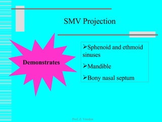 SMV Projection Prof. Z. Vinokur Demonstrates Sphenoid and ethmoid sinuses Mandible Bony nasal septum 