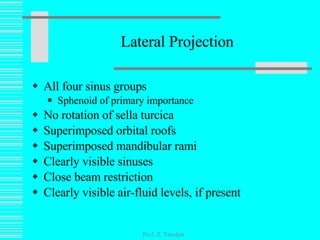 Lateral Projection All four sinus groups Sphenoid of primary importance No rotation of sella turcica Superimposed orbital roofs Superimposed mandibular rami Clearly visible sinuses Close beam restriction Clearly visible air-fluid levels, if present Prof. Z. Vinokur 