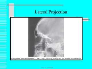 Lateral Projection Prof. Z. Vinokur 