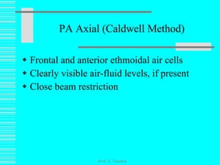 PA Axial (Caldwell Method) Frontal and anterior ethmoidal air cells Clearly visible air-fluid levels, if present Close beam restriction Prof. Z. Vinokur 