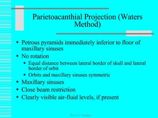 Petrous pyramids immediately inferior to floor of maxillary sinuses No rotation Equal distance between lateral border of skull and lateral border of orbit Orbits and maxillary sinuses symmetric Maxillary sinuses Close beam restriction Clearly visible air-fluid levels, if present Parietoacanthial Projection (Waters Method) Prof. Z. Vinokur 
