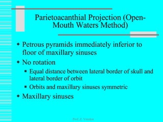 Petrous pyramids immediately inferior to floor of maxillary sinuses No rotation Equal distance between lateral border of skull and lateral border of orbit Orbits and maxillary sinuses symmetric Maxillary sinuses Parietoacanthial Projection (Open-Mouth Waters Method) Prof. Z. Vinokur 