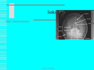 links Prof. Z. Vinokur http://classes.kumc.edu/som/radanatomy/results2.asp?RegionID=1&PathologyID=2 