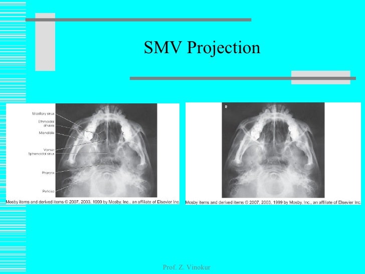 Lec1222509slideshare
