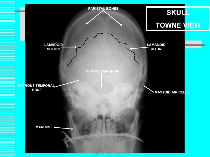 Lec1222509slideshare