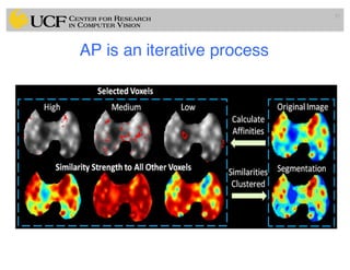 Medical Image Segmentation Methods Lec13: Clustering Based Medical Image Segmentation Methods | PDF