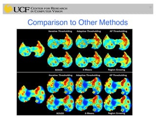 Lec13: Clustering Based Medical Image Segmentation Methods | PDF