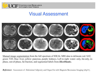 Lec14: Evaluation Framework for Medical Image Segmentation | PDF
