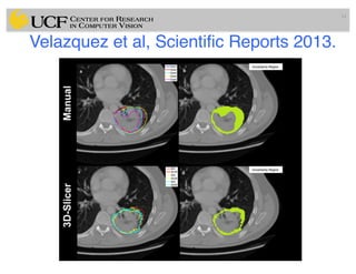 Lec14: Evaluation Framework for Medical Image Segmentation | PDF
