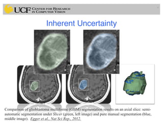Lec14: Evaluation Framework for Medical Image Segmentation | PDF