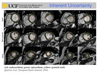 Lec14: Evaluation Framework for Medical Image Segmentation | PDF