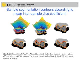Lec14: Evaluation Framework for Medical Image Segmentation | PDF