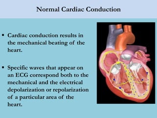 Normal Cardiac Conduction
 Cardiac conduction results in
the mechanical beating of the
heart.
 Specific waves that appear on
an ECG correspond both to the
mechanical and the electrical
depolarization or repolarization
of a particular area of the
heart.
 