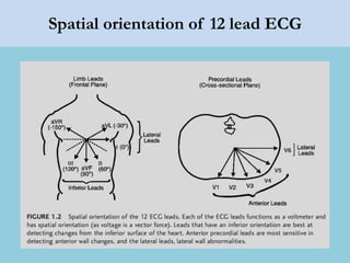 Spatial orientation of 12 lead ECG
 
