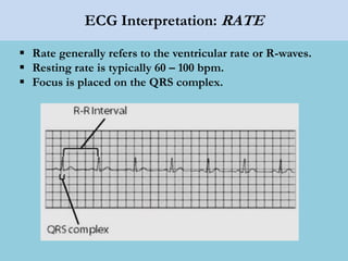 ECG Interpretation: RATE
 Rate generally refers to the ventricular rate or R-waves.
 Resting rate is typically 60 – 100 bpm.
 Focus is placed on the QRS complex.
 
