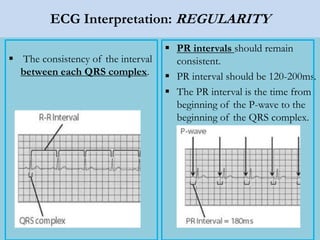 ECG Interpretation: REGULARITY
 The consistency of the interval
between each QRS complex.
 PR intervals should remain
consistent.
 PR interval should be 120-200ms.
 The PR interval is the time from
beginning of the P-wave to the
beginning of the QRS complex.
 