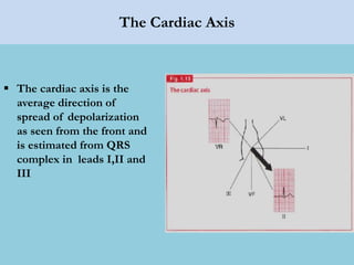 The Cardiac Axis
 The cardiac axis is the
average direction of
spread of depolarization
as seen from the front and
is estimated from QRS
complex in leads I,II and
III
 