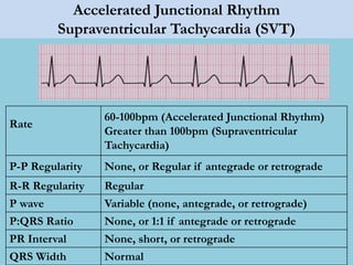 Accelerated Junctional Rhythm
Supraventricular Tachycardia (SVT)
Rate
60-100bpm (Accelerated Junctional Rhythm)
Greater than 100bpm (Supraventricular
Tachycardia)
P-P Regularity None, or Regular if antegrade or retrograde
R-R Regularity Regular
P wave Variable (none, antegrade, or retrograde)
P:QRS Ratio None, or 1:1 if antegrade or retrograde
PR Interval None, short, or retrograde
QRS Width Normal
 