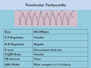 Ventricular Tachycardia
Rate 100-200bpm
P-P Regularity Variable
R-R Regularity Regular
P wave Dissociated atrial rate
P:QRS Ratio Variable
PR Interval None
QRS Width Wide complex (>/= 0.12sec).
 
