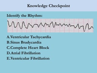 Knowledge Checkpoint
Identify the Rhythm:
A.Ventricular Tachycardia
B.Sinus Bradycardia
C.Complete Heart Block
D.Atrial Fibrillation
E.Ventricular Fibrillation
 