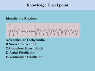 Knowledge Checkpoint
Identify the Rhythm:
A.Ventricular Tachycardia
B.Sinus Bradycardia
C.Complete Heart Block
D.Atrial Fibrillation
E.Ventricular Fibrillation
 