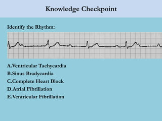 Knowledge Checkpoint
Identify the Rhythm:
A.Ventricular Tachycardia
B.Sinus Bradycardia
C.Complete Heart Block
D.Atrial Fibrillation
E.Ventricular Fibrillation
 