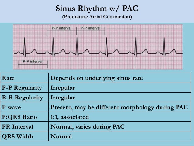 Lec 14 Basic Ecg Interpretation For Mohs Lec 14 Basic Ecg Interpretation For Mohs