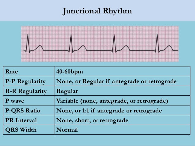 Lec 14 Basic Ecg Interpretation For Mohs