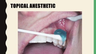 TOPICAL ANESTHETIC
 