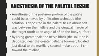 ANESTHESIA OF THE PALATAL TISSUE
• Anesthesia of the posterior portion of the palate
could be achieved by infiltration technique (the
solution is deposited in the palatal tissue about half
way between the midline and the gingival margin of
the target tooth at an angle of 45 to the bony surface)
• by using greater palatine nerve block (the solution is
deposited near the greater palatine foramen, located
just distal to the maxillary second molar about 1 cm
toward the midline)
 