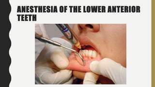 ANESTHESIA OF THE LOWER ANTERIOR
TEETH
 