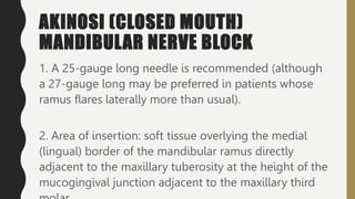 AKINOSI (CLOSED MOUTH)
MANDIBULAR NERVE BLOCK
1. A 25-gauge long needle is recommended (although
a 27-gauge long may be preferred in patients whose
ramus flares laterally more than usual).
2. Area of insertion: soft tissue overlying the medial
(lingual) border of the mandibular ramus directly
adjacent to the maxillary tuberosity at the height of the
mucogingival junction adjacent to the maxillary third
 