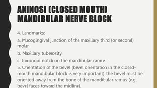 AKINOSI (CLOSED MOUTH)
MANDIBULAR NERVE BLOCK
4. Landmarks:
a. Mucogingival junction of the maxillary third (or second)
molar.
b. Maxillary tuberosity.
c. Coronoid notch on the mandibular ramus.
5. Orientation of the bevel (bevel orientation in the closed-
mouth mandibular block is very important): the bevel must be
oriented away from the bone of the mandibular ramus (e.g.,
bevel faces toward the midline).
 