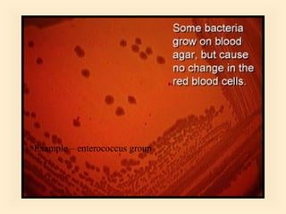 Example – enterococcus group

10

 