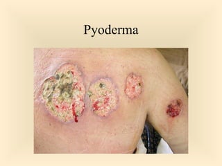 Pyoderma

39

 