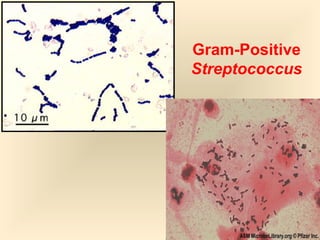 Gram-Positive
Streptococcus

5

 